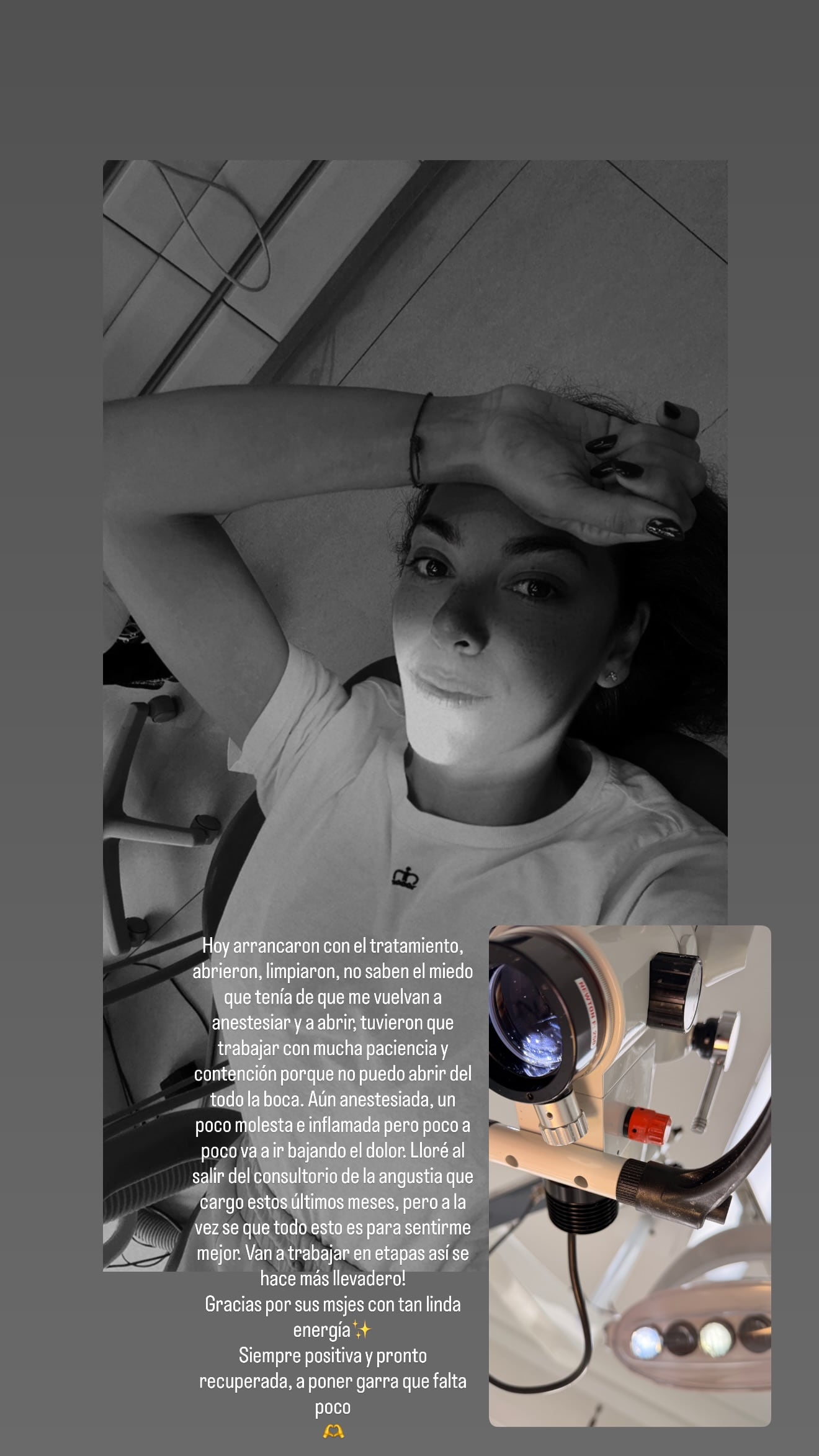 La modelo compartió detalles de su dolorosa afección en la cara y contó cómo el trismus dificulta su recuperación