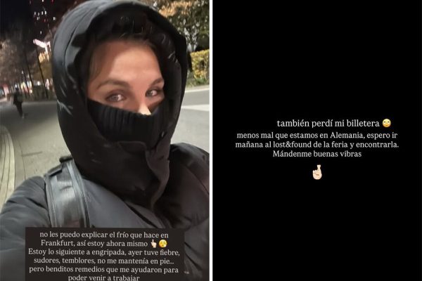 Ivana Icardi se realizó un retoque estético y compartió el inconveniente que tuvo tras la operación