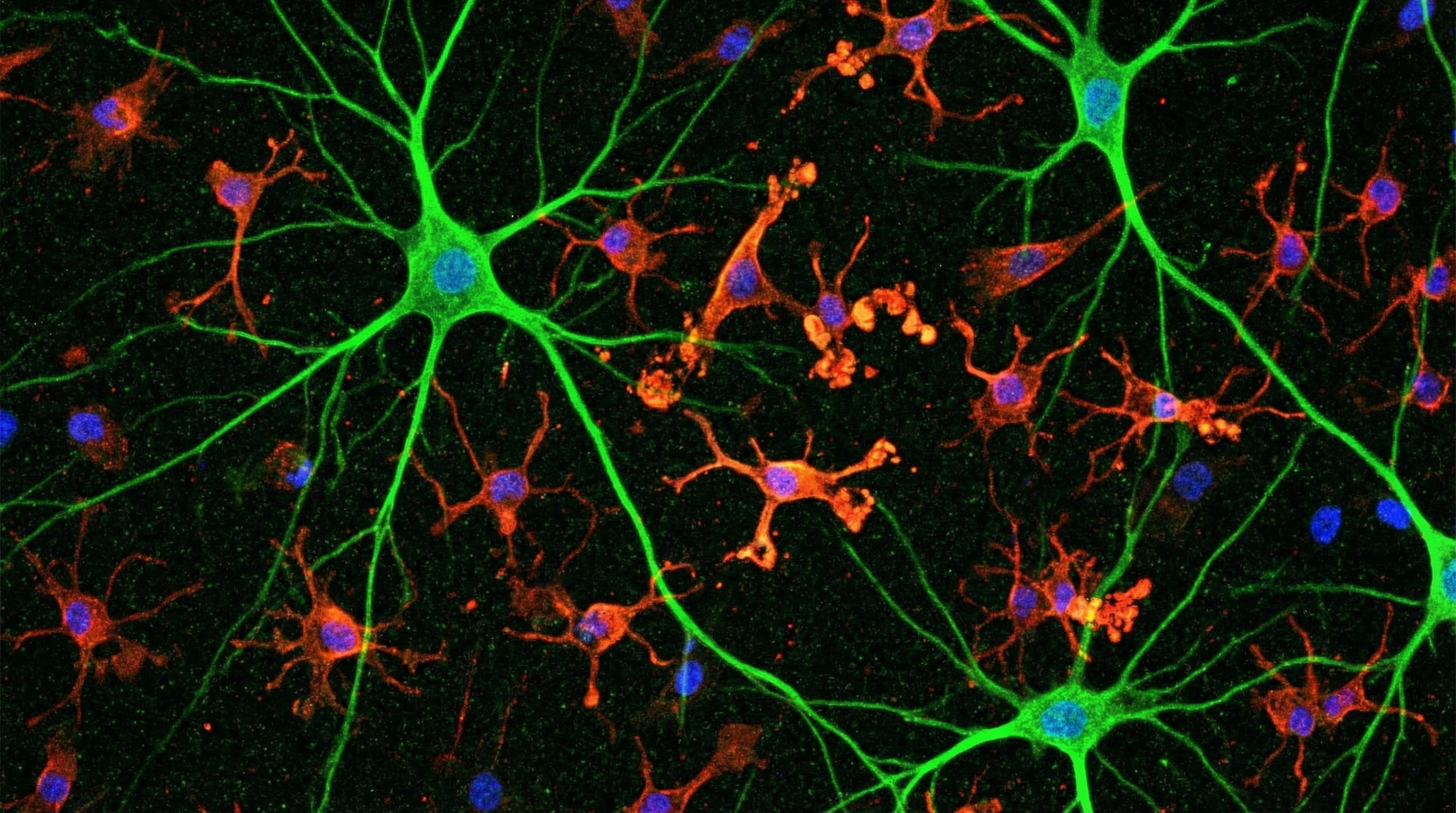 El Radboud University Medical Center y el Amsterdam UMC analizaron la actividad cerebral de 128 niños y adolescentes (Imagen Ilustrativa Infobae)