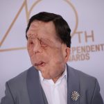 Premios Oscar 2026: qué es y cómo se trata la neurofibromatosis, la enfermedad que tiene el actor Adam Pearson