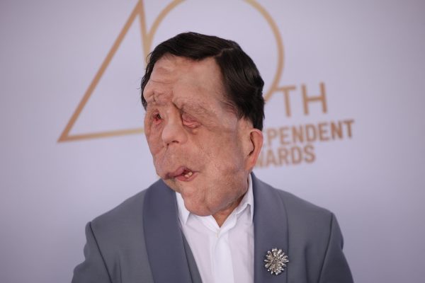 Premios Oscar 2026: qué es y cómo se trata la neurofibromatosis, la enfermedad que tiene el actor Adam Pearson