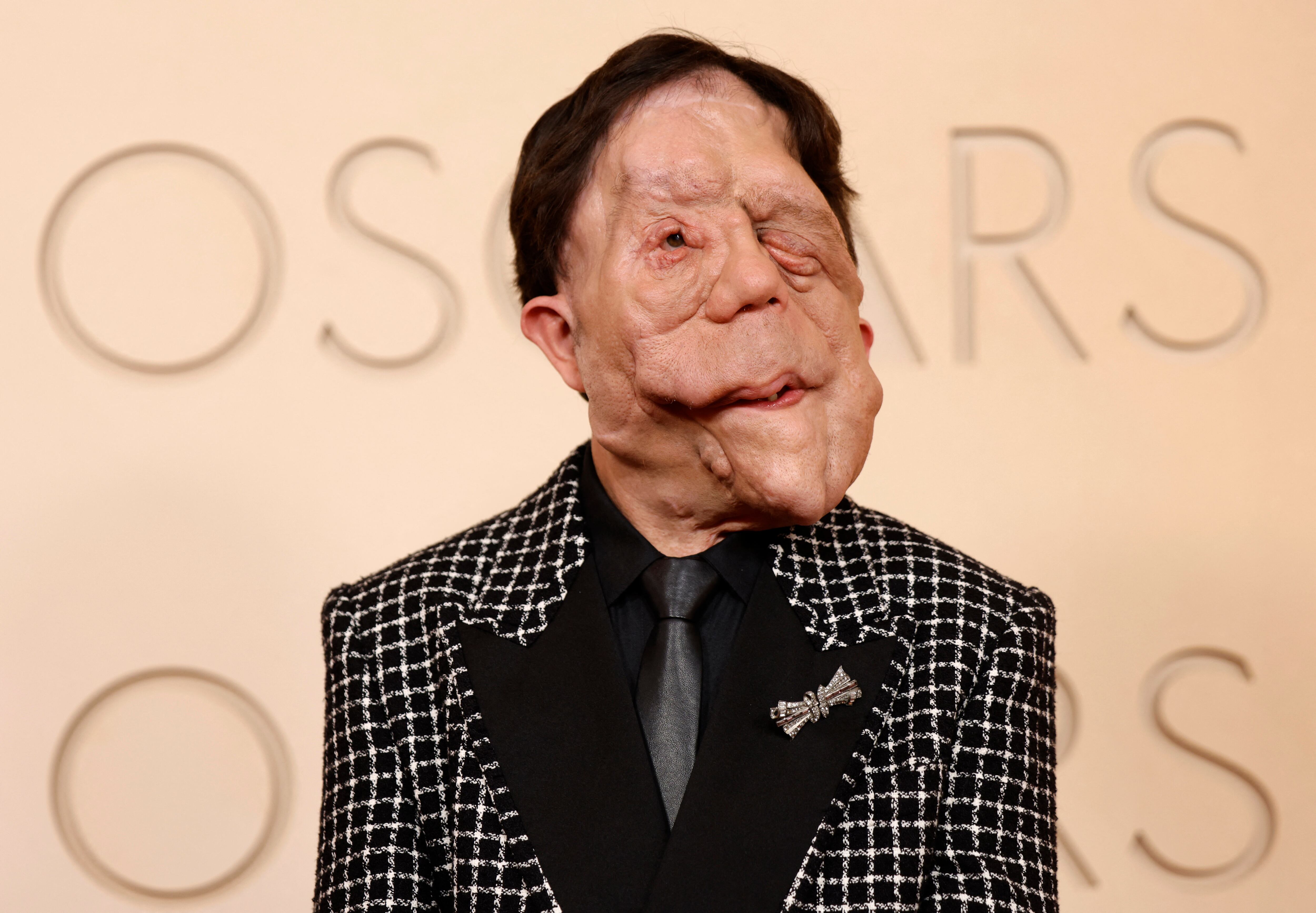 Adam Pearson se convierte en referente de resiliencia y autenticidad al desfilar por la alfombra roja de los premios Oscar 2026 /REUTERS/Caroline Brehman