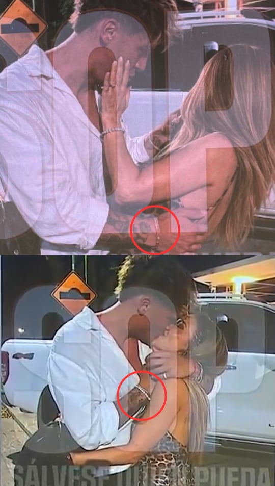 En las fotos, que se supone que son del mismo momento, Ian tiene dos pulseras diferentes 