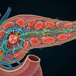 Una terapia experimental logró “interceptar” el cáncer de páncreas al detectar lesiones precursoras del tumor