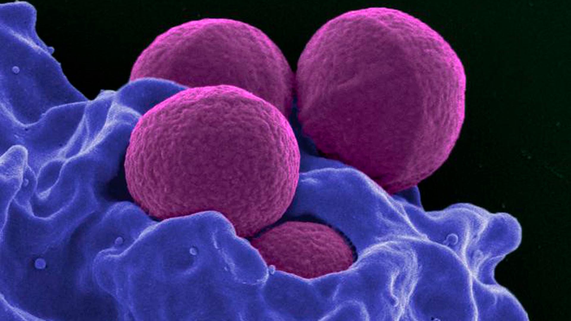 SyntheMol-RL genera moléculas nuevas que muestran alta eficacia contra Staphylococcus aureus resistente a la meticilina en pruebas de laboratorio./Archivo NIH