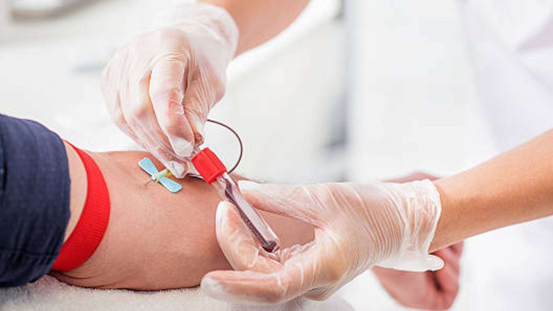 Los tipos de sangre raros como Rhnull y AB negativo exigen estrategias especiales en la gestión de reservas y campañas de donación adaptadas a cada región (Foto: (iStock))