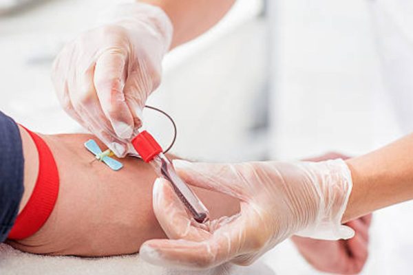 Cuáles son los tipos de sangre más extraños del mundo y qué riesgos implican