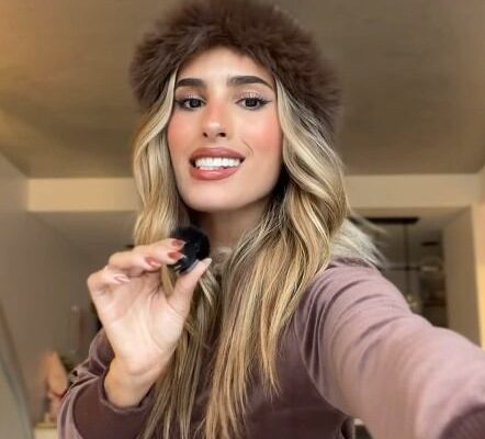 El contundente descargo de Juli Poggio después de las críticas recibidas por sus implantes dentales: “Dejen de opinar”