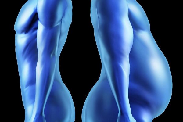 Grasa abdominal oculta vinculada al control de la vejiga en mujeres