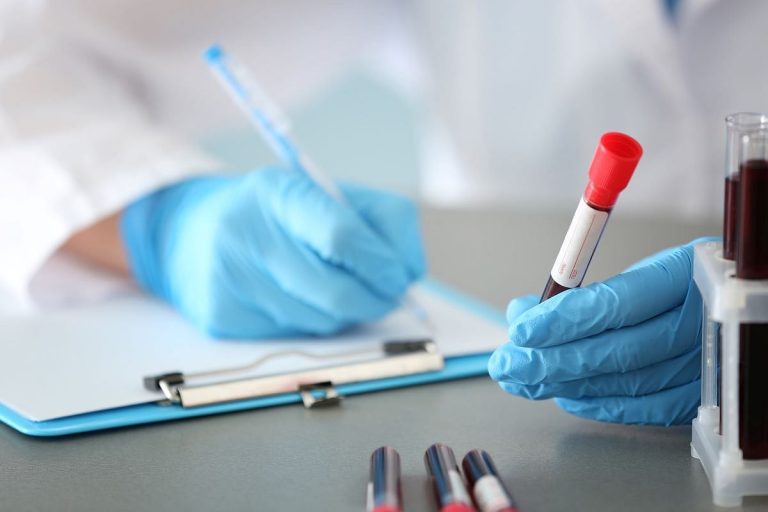 La mayoría de la gente se haría un análisis de sangre para Alzheimer, según un estudio