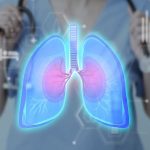 Las nuevas tecnologías hacen que el diagnóstico y tratamiento del cáncer de pulmón sean más rápidos y seguros