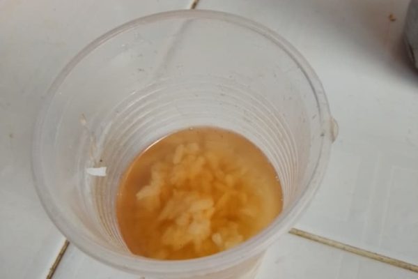 Prisoners Defenders denunció que 90.000 presos sufren daños irreversibles por desnutrición y condiciones inhumanas en Cuba