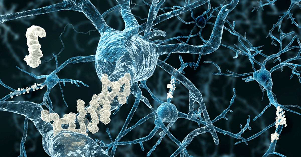 El avance impulsado por Siemens Healthineers posibilita analizar muestras de miles de personas y superar las molestias de los métodos diagnósticos (gentileza: UC San Diego)