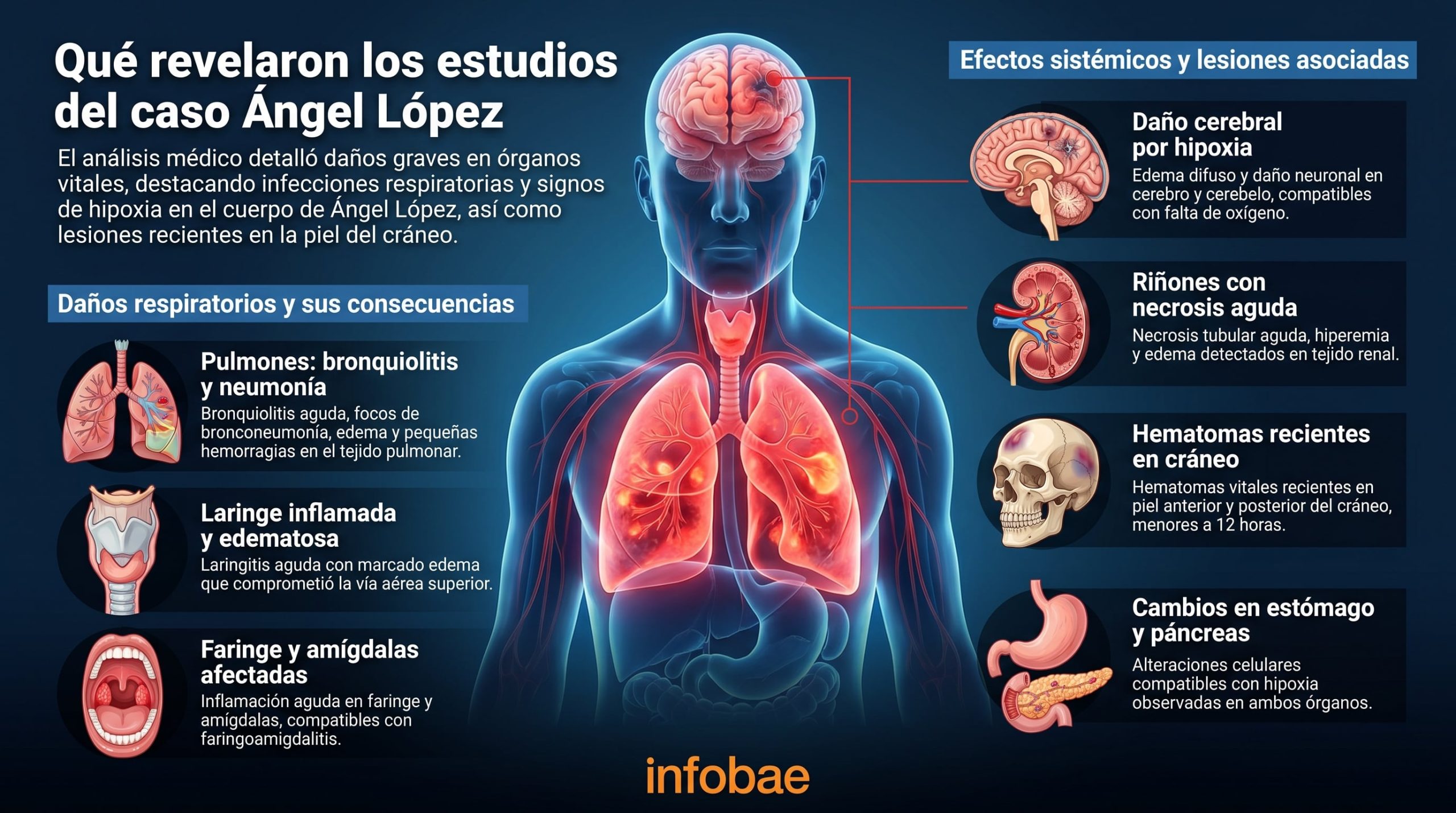 Agravaron la imputación de la madre de Ángel López