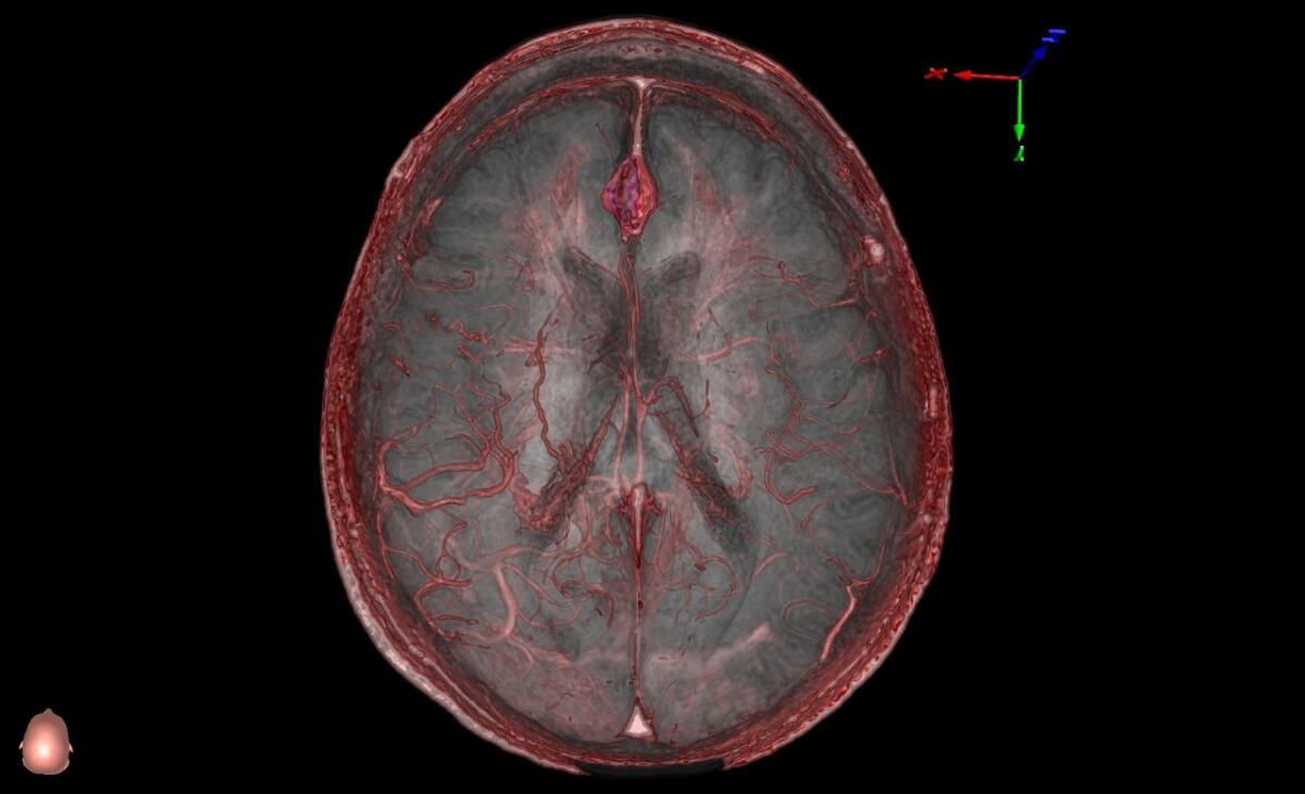 Cursos precongreso en hospitales porteños ofrecen formación avanzada en técnicas de cirugía ventricular, base de cráneo y columna vertebral
(Universidad de Stanford) 