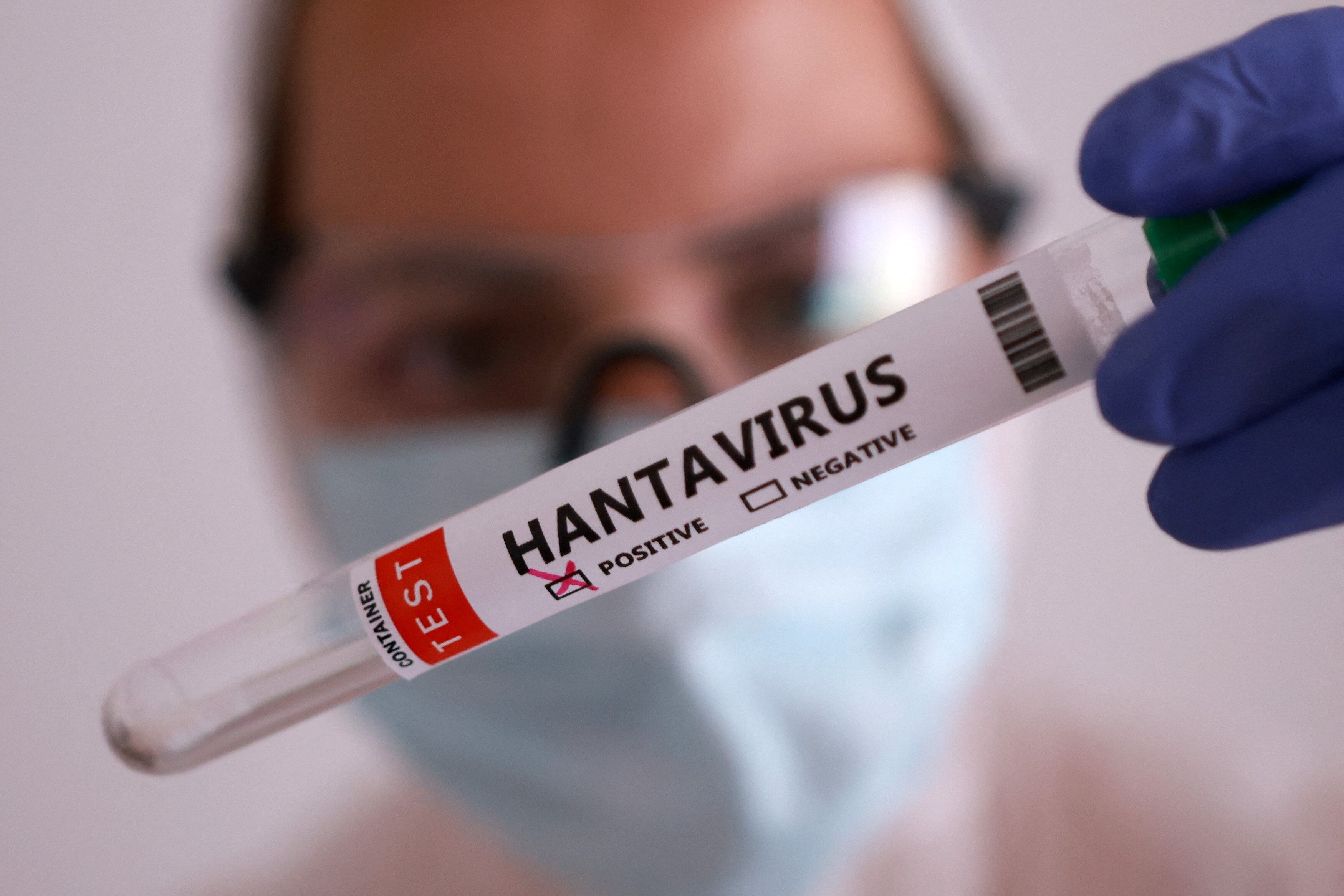 La cepa Andes del hantavirus fue responsable de la transmisión persona a persona y motivó el desarrollo de nuevos protocolos de contención en Argentina (REUTERS/Dado Ruvic/Illustration)
