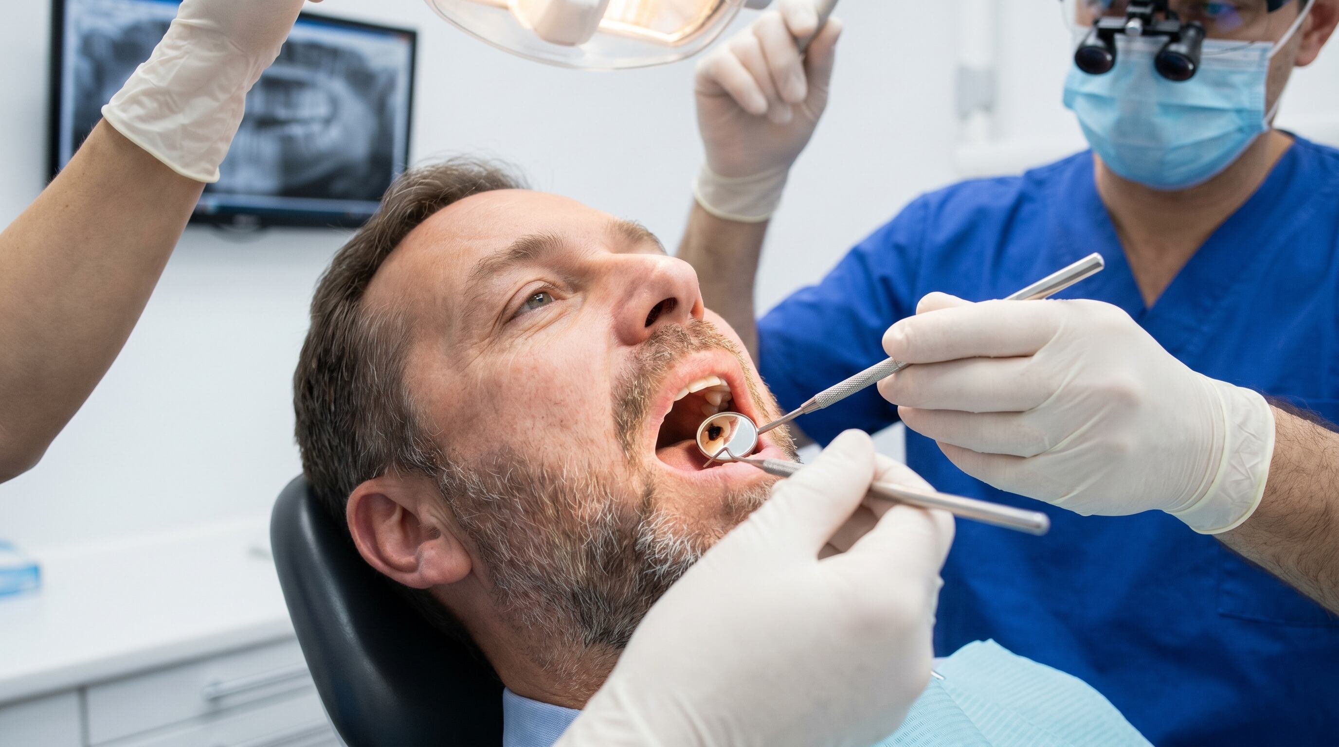 Las caries graves se vinculan a riesgos de salud general, como enfermedades cardiovasculares (Imagen Ilustrativa Infobae)