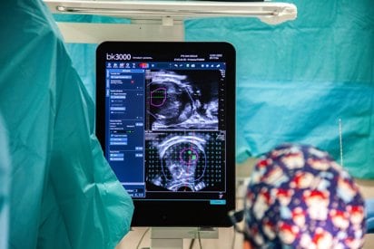 Por cada mil hombres que se someten al análisis de PSA se previenen una o dos muertes por cáncer de próstata, según la revisión internacional