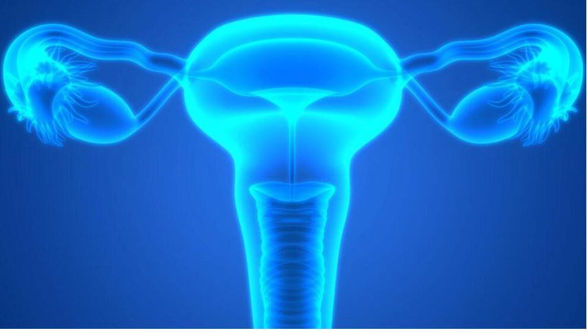 En Argentina se diagnostican aproximadamente 2.200 casos de cáncer de ovario cada año, según la OMS y GLOBOCAN 