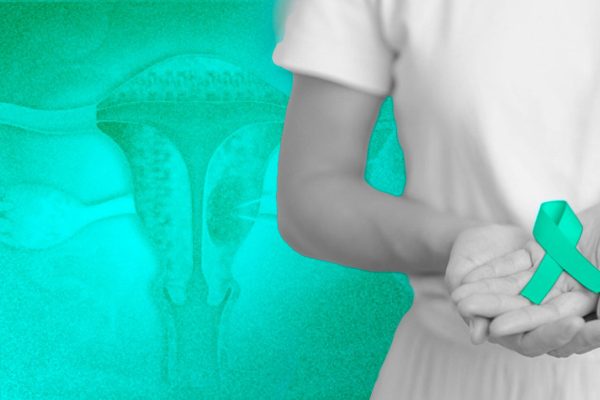 Día Mundial del Cáncer de Ovario: cuáles son los síntomas y los principales factores de riesgo