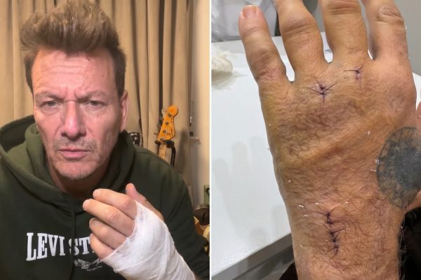 El músico Javier Malosetti sufrió un duro accidente que le impide tocar y contó cómo es su rehabilitación: “Días tristes”