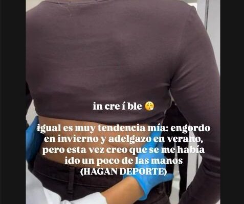 Ivana Icardi mostró el antes y después de su operación estética: “Se me había ido un poco de las manos”