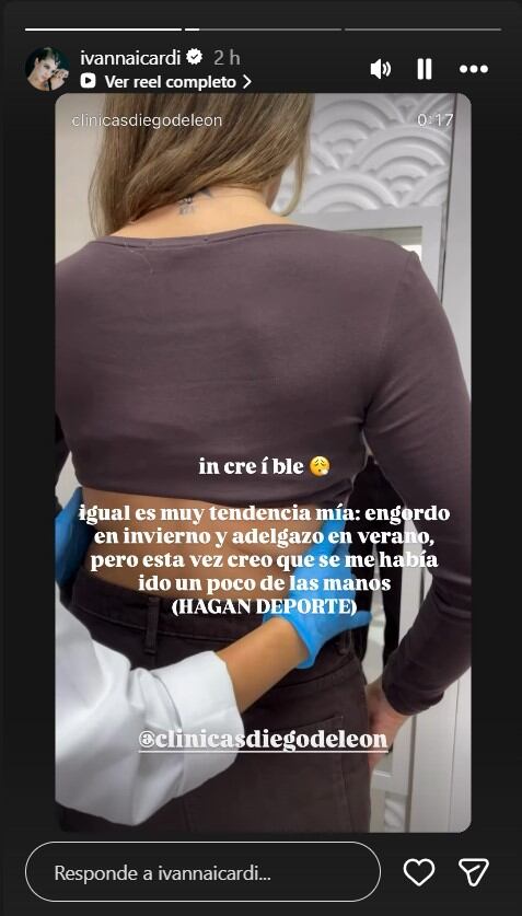 Ivana Icardi mostró el antes y después de su operación estética: “Se me había ido un poco de las manos”