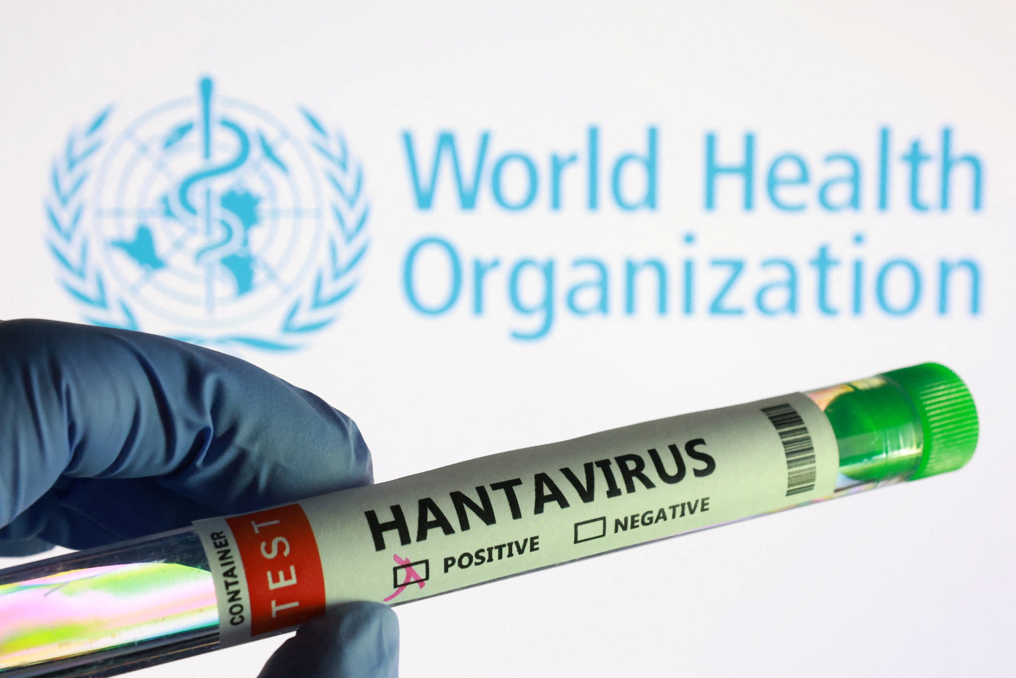 El hantavirus es una zoonosis producida por virus ARN, en América predomina el síndrome cardiopulmonar y en Asia la fiebre hemorrágica renal.- REUTERS/Dado Ruvic/Ilustración