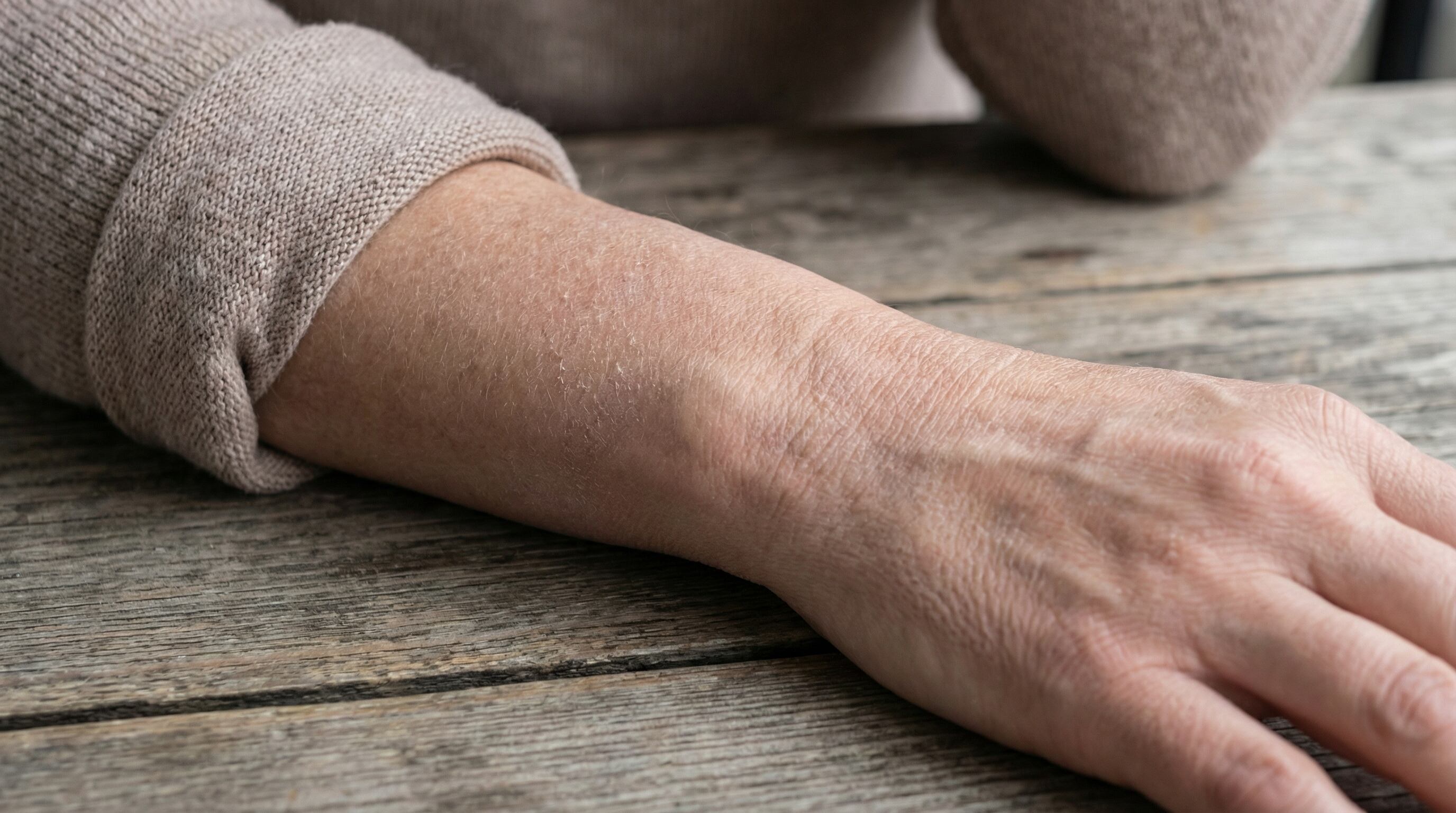 La piel seca, el cabello fino y la fatiga persistente pueden indicar problemas en la tiroides, afectando el metabolismo y el riesgo cardiovascular (Imagen Ilustrativa Infobae)