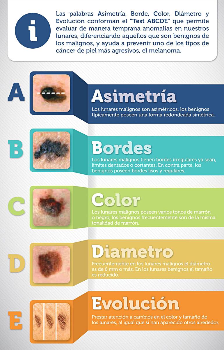 La autoobservación y la regla ABCDE permiten detectar señales de alerta en lunares y manchas para consultar al dermatólogo a tiempo 