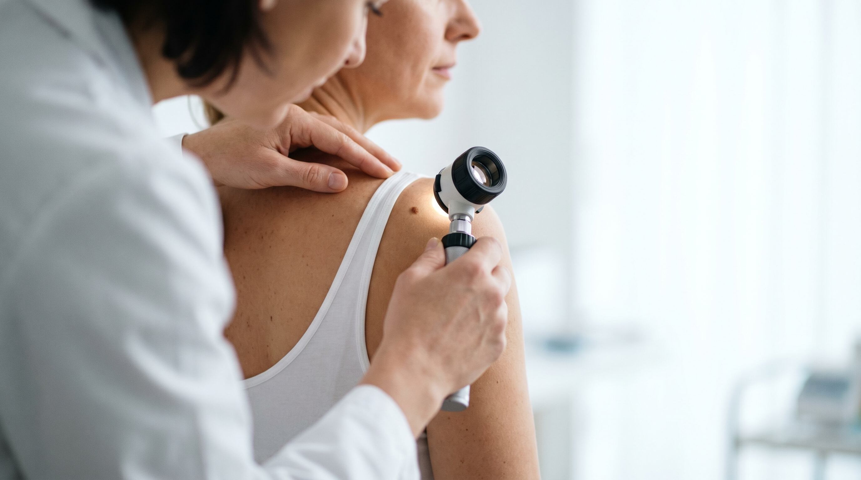 El melanoma es uno de los 20 cánceres más frecuentes en Argentina y su incidencia podría aumentar un 41% para 2045 según proyecciones oficiales (Imagen Ilustrativa Infobae)