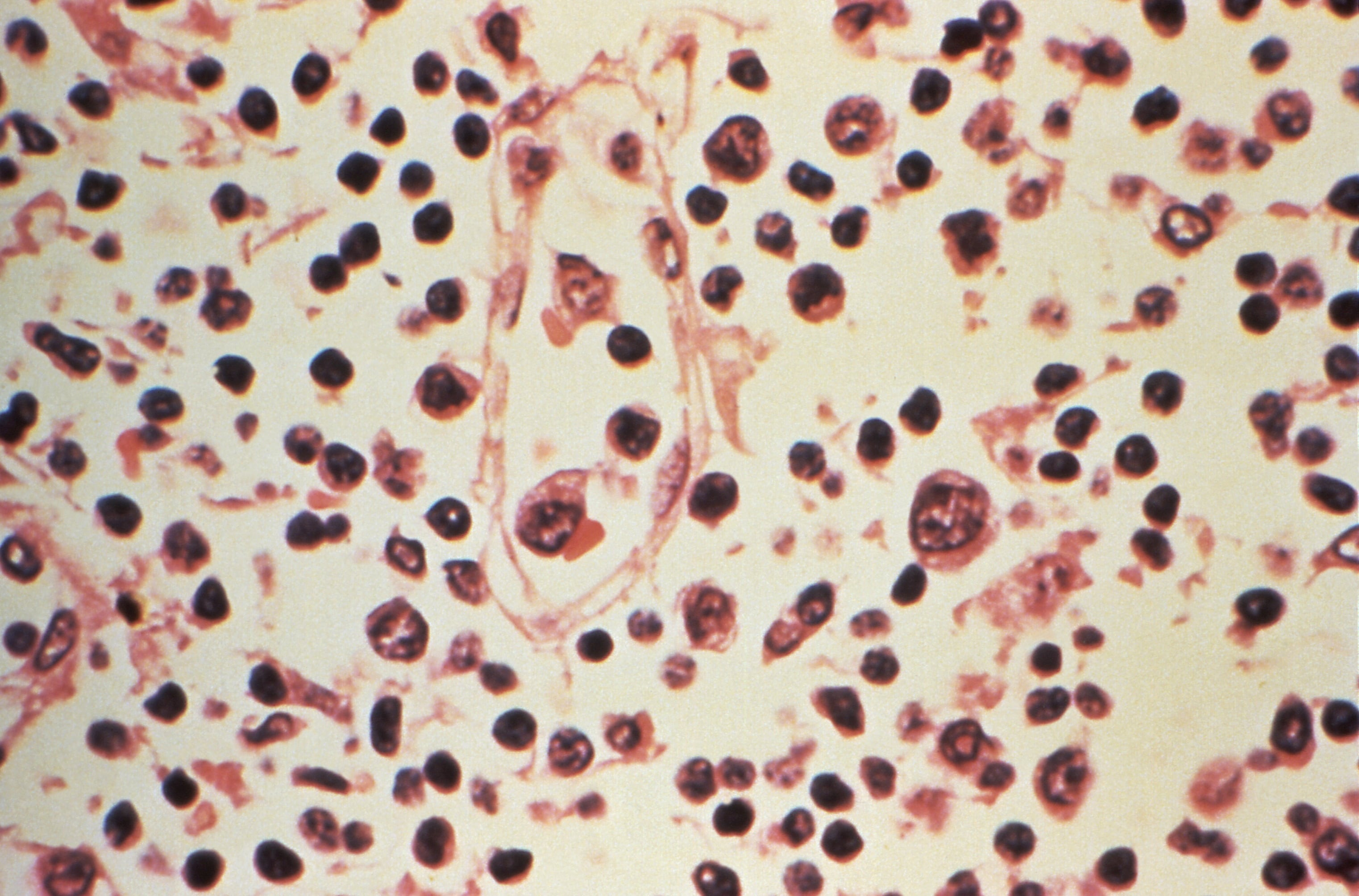 No existe una vacuna para el hantavirus, la prevención se basa en evitar el contacto con roedores y la limpieza cuidadosa de los ambientes. - Reuters