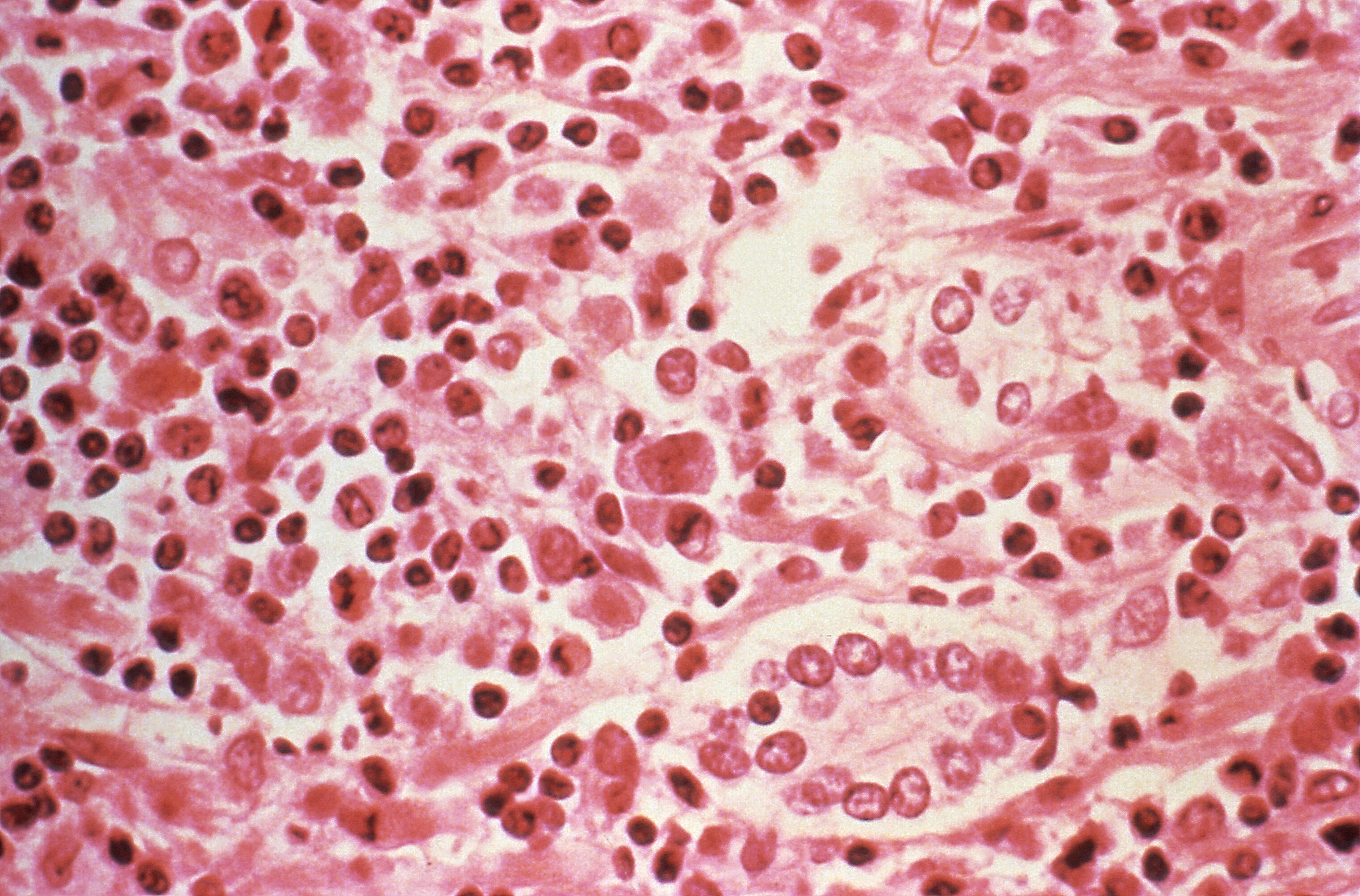 En América Latina la variante Andes del hantavirus es la única capaz de transmisión entre personas aunque sólo en contactos muy estrechos. - Centers for Disease Control and Prevention/Handout via REUTERS 