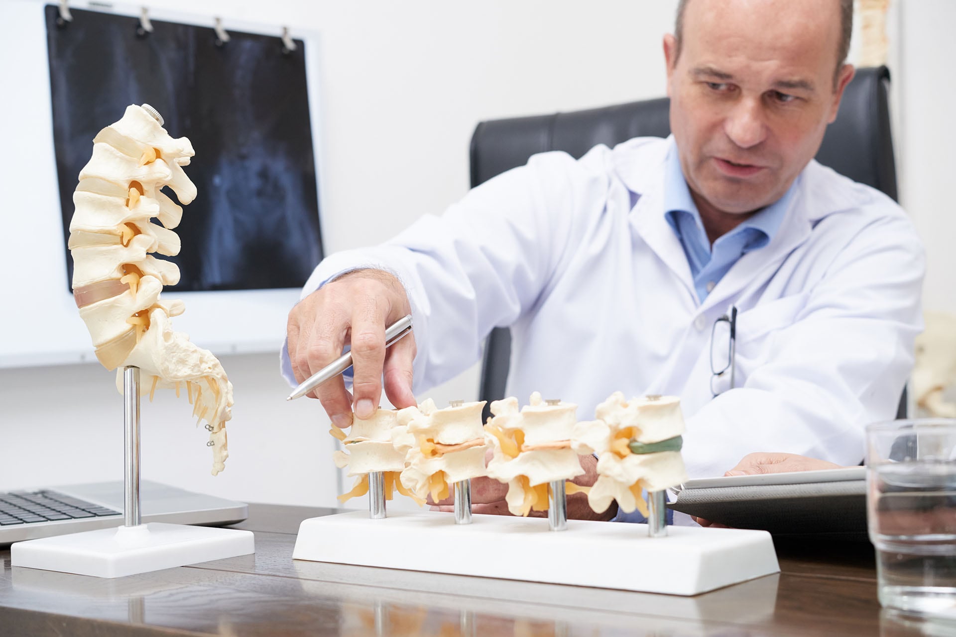 La osteoporosis afecta a uno de cada cinco personas en el mundo y suele diagnosticarse tarde por falta de métodos accesibles./Archivo Imagen Ilustrativa Infobae