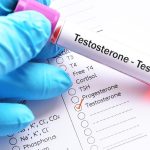 A muchos hombres se les prescribe testosterona sin pruebas adecuadas