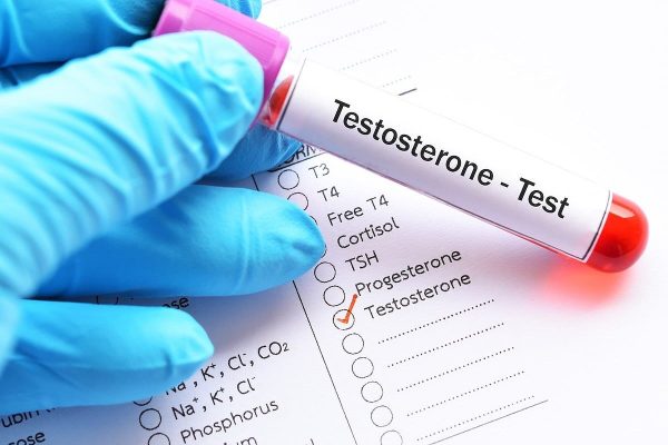 A muchos hombres se les prescribe testosterona sin pruebas adecuadas