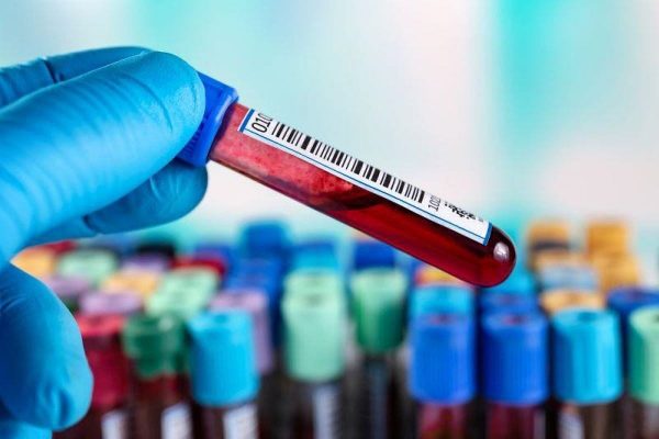 Análisis de sangre de nueva generación mejora la detección del cáncer de próstata agresivo