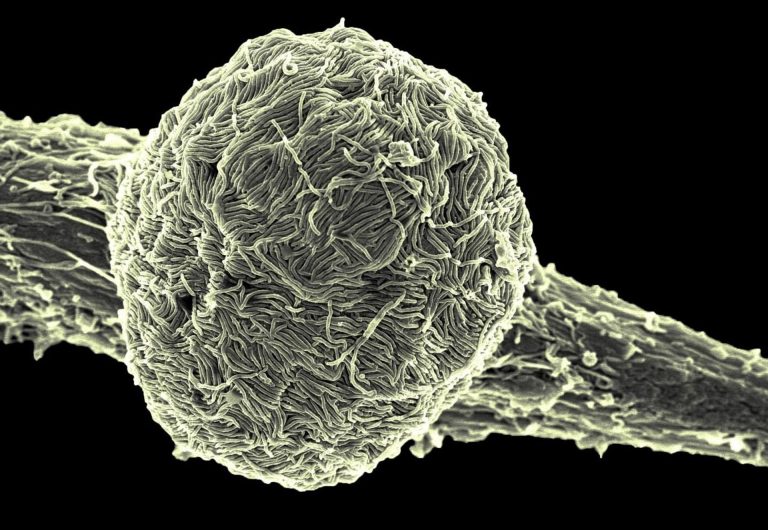 Brasil descartó uno de dos casos sospechosos de ébola: el paciente que queda por confirmar está internado en grave estado