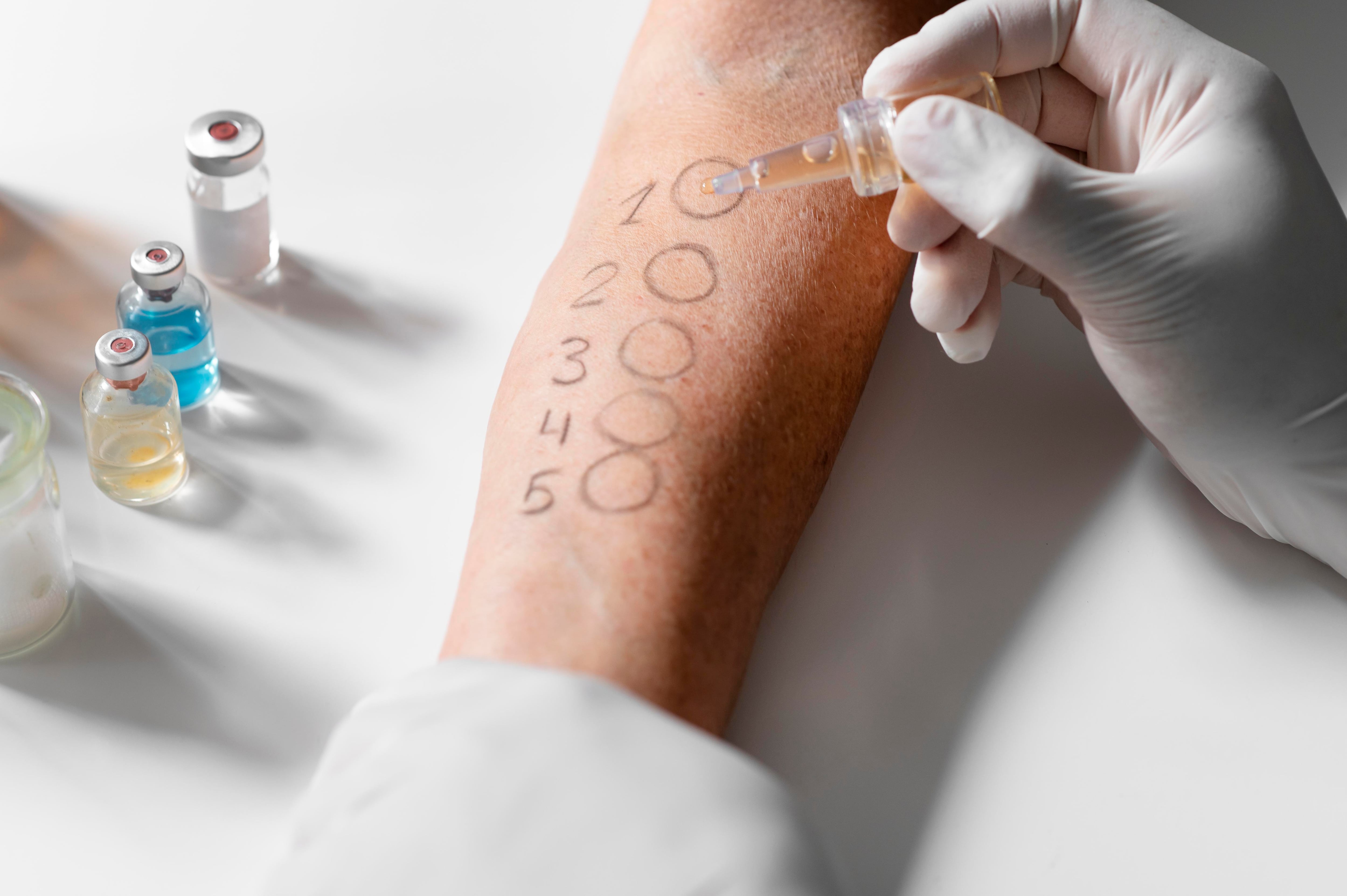 Las pruebas cutáneas ayudan a confirmar o descartar una respuesta inmunológica frente a un medicamento sospechoso (Crédito: Freepik)
