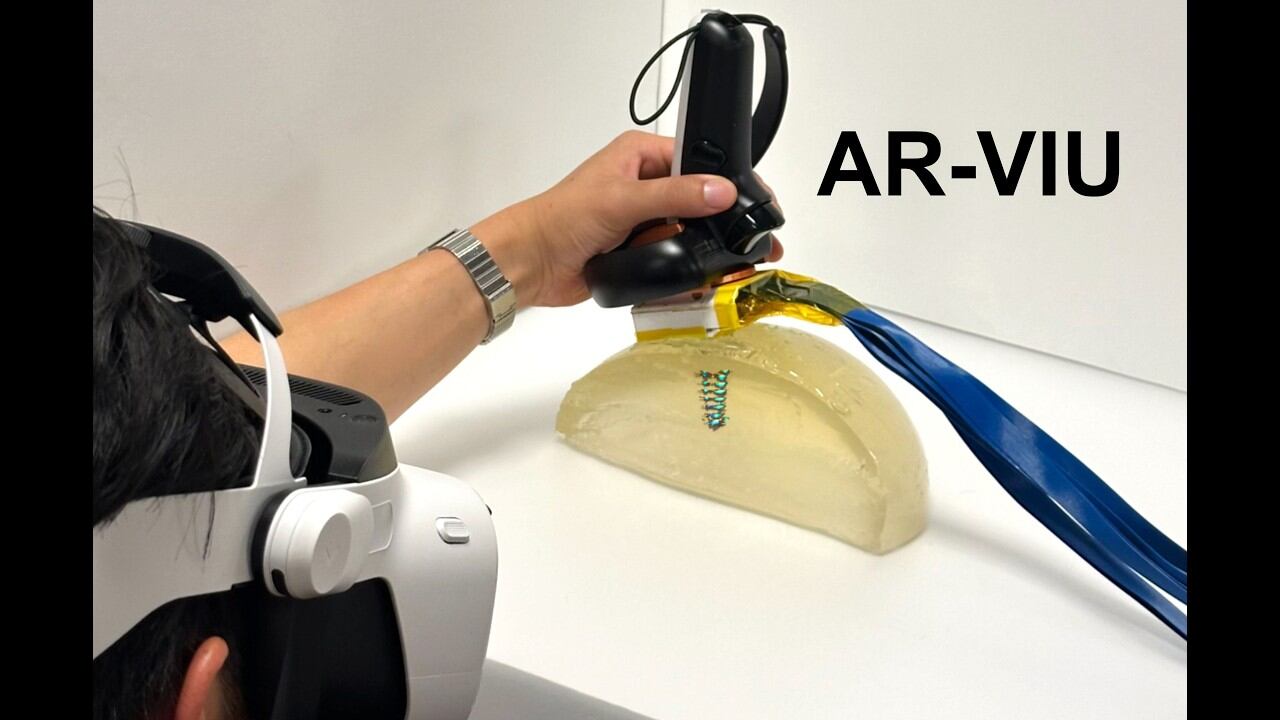 El MIT desarrolló AR-VIU para reducir la carga cognitiva de reconstruir cortes de ecografía 2D en una imagen mental 3D durante la exploración (MIT)