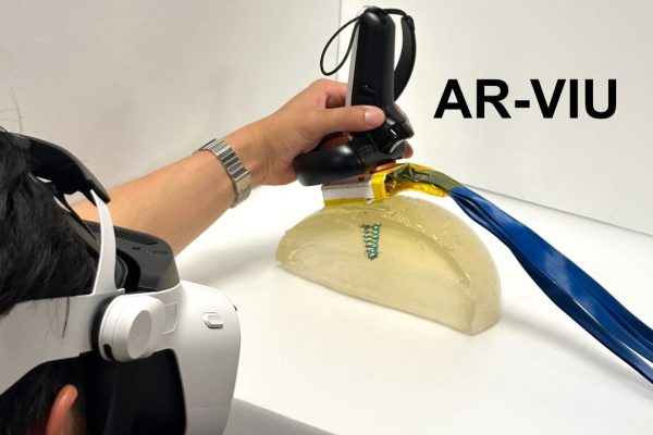 Cómo funciona el innovador dispositivo del MIT que podría hacer las biopsias más precisas