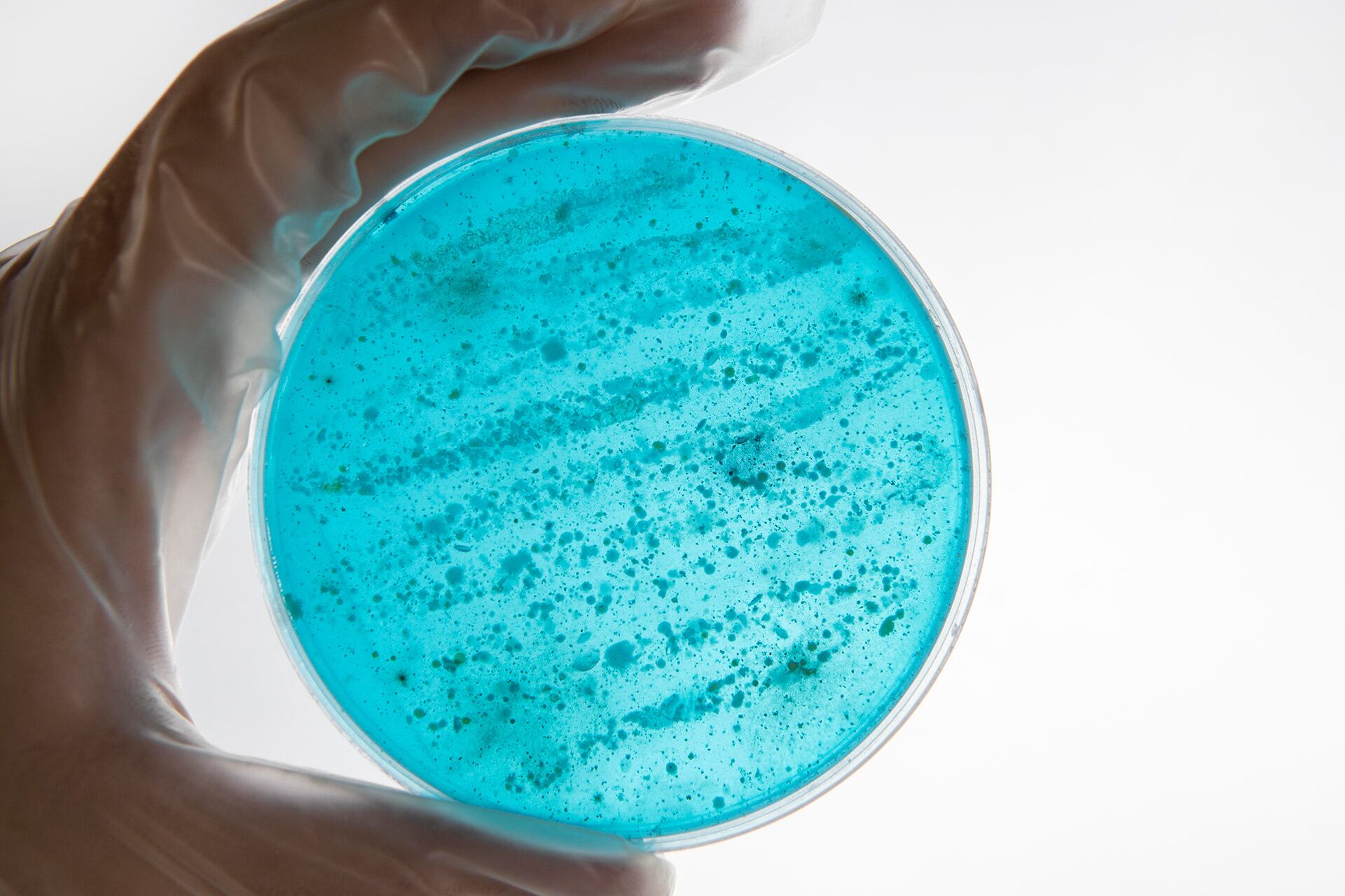 La plataforma VDS usa una cepa inofensiva de Salmonella para transportar el material genético del parvovirus H-1 y liberarlo dentro de las células cancerosas (Freepik)