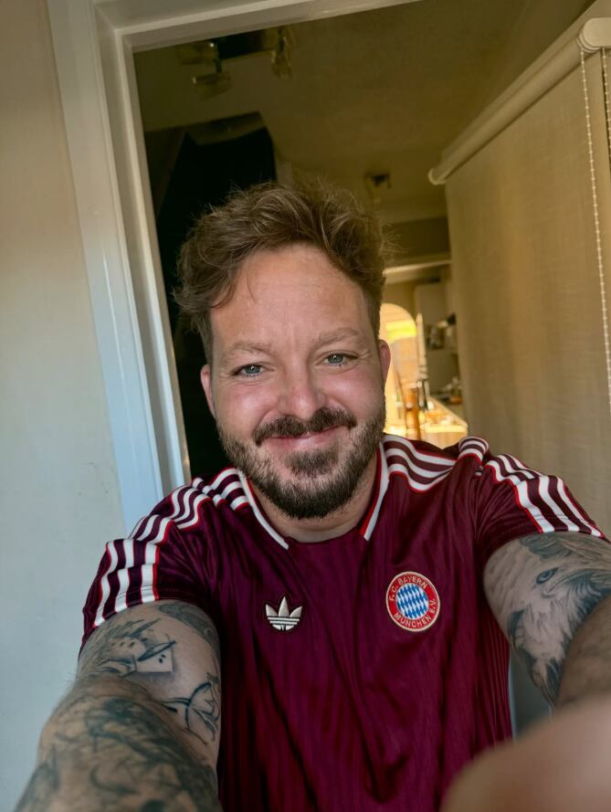 La neurofibromatosis tipo 2 puede pasar inadvertida cuando síntomas como sordera, debilidad en las piernas o falta de coordinación se confunden con el envejecimiento (Michael Archer Instagram)