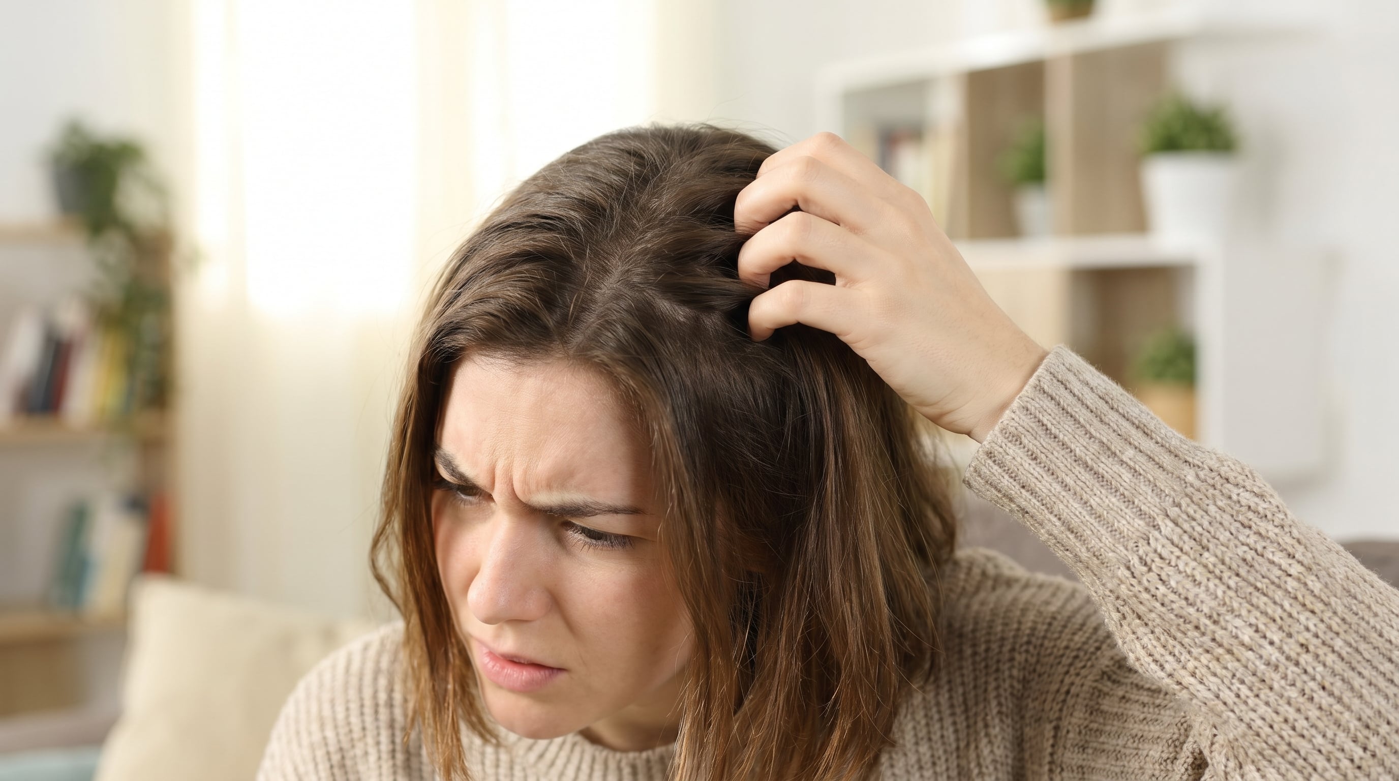 El rascado repetido por la picazón de la caspa puede lesionar el cuero cabelludo, agravar la rotura del cabello y aumentar su desprendimiento (Imagen Ilustrativa Infobae)