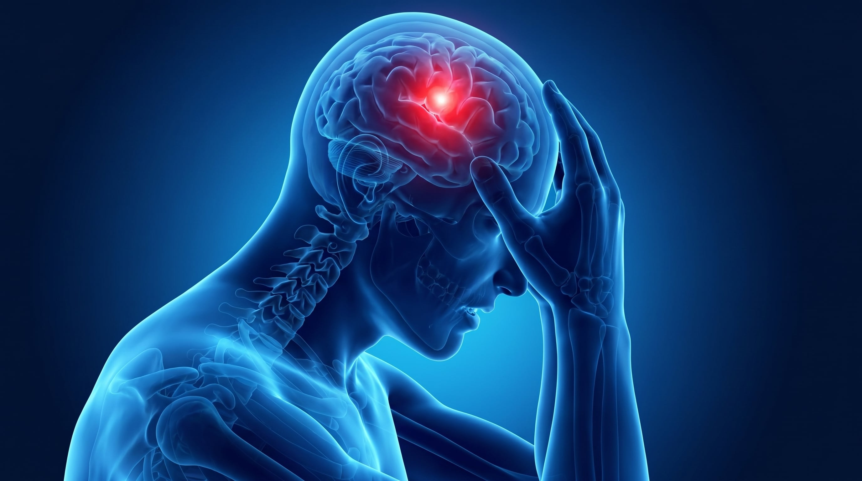 La migraña puede presentarse con aura o sin aura, y la forma con aura incluye síntomas neurológicos transitorios como destellos, líneas en zigzag, hormigueo o debilidad (Imagen Ilustrativa Infobae)