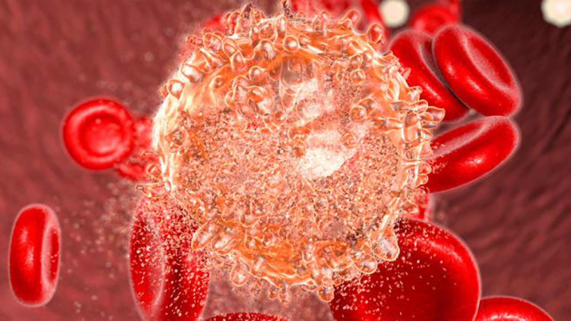 La leucopenia prolongada puede provocar infecciones recurrentes, cansancio, debilidad, heridas de curación lenta y aftas en la boca 