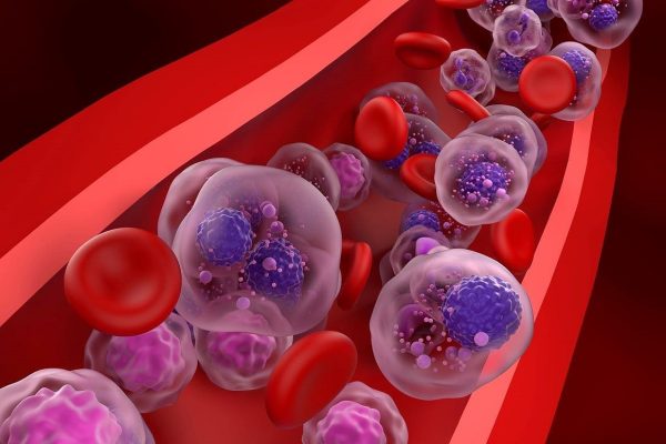Medicamento sin quimio muestra una gran supervivencia y mejora en la remisión de las recaídas del mieloma múltiple