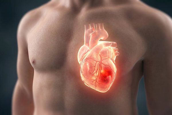 Presión arterial alta, los cardiólogos revelan los hábitos que más la afectan