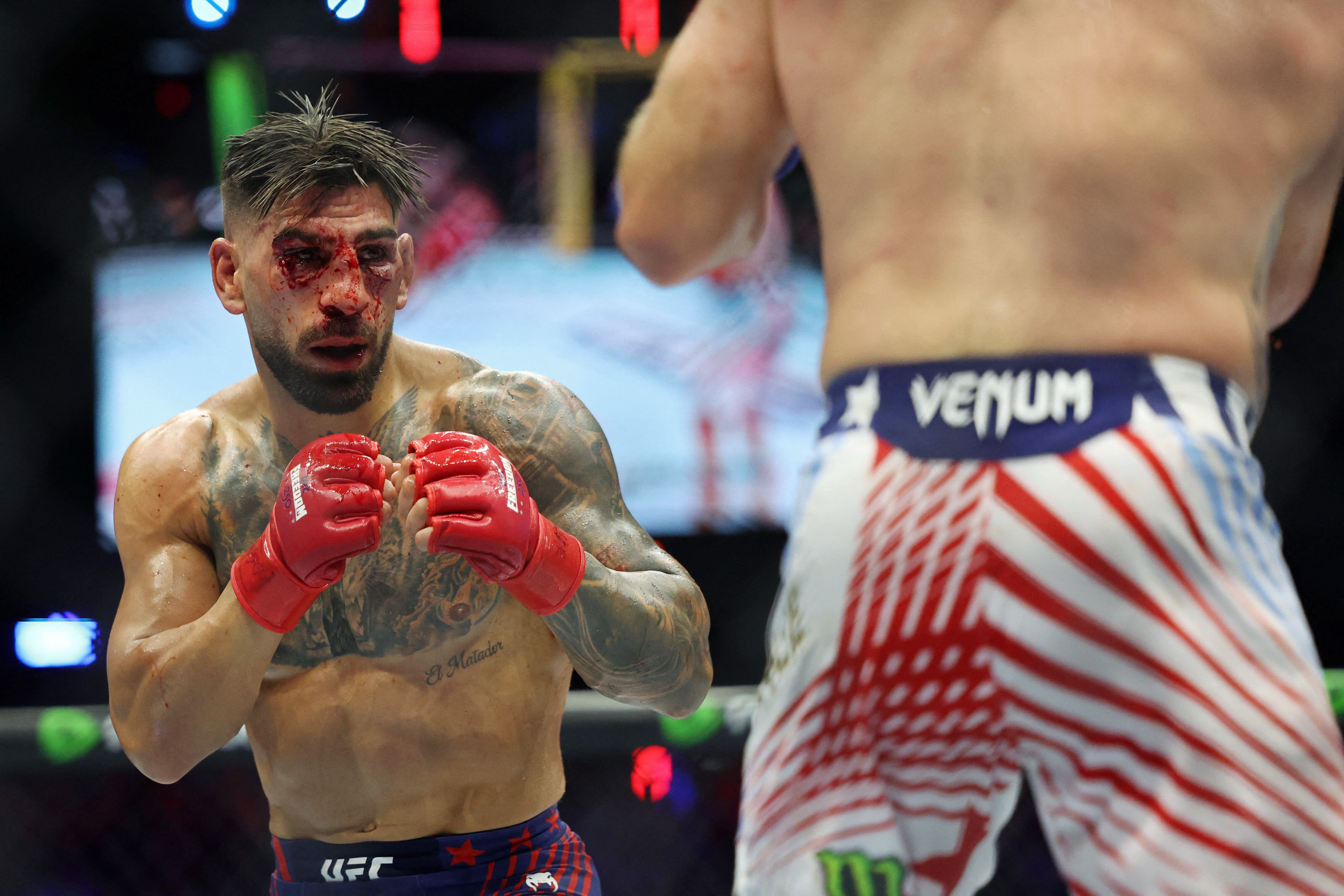 Especialista advirtió que la inflamación extrema tras el UFC Freedom 250 puede esconder daños internos o una fractura orbital - Credit: Amber Searls-Imagn Images