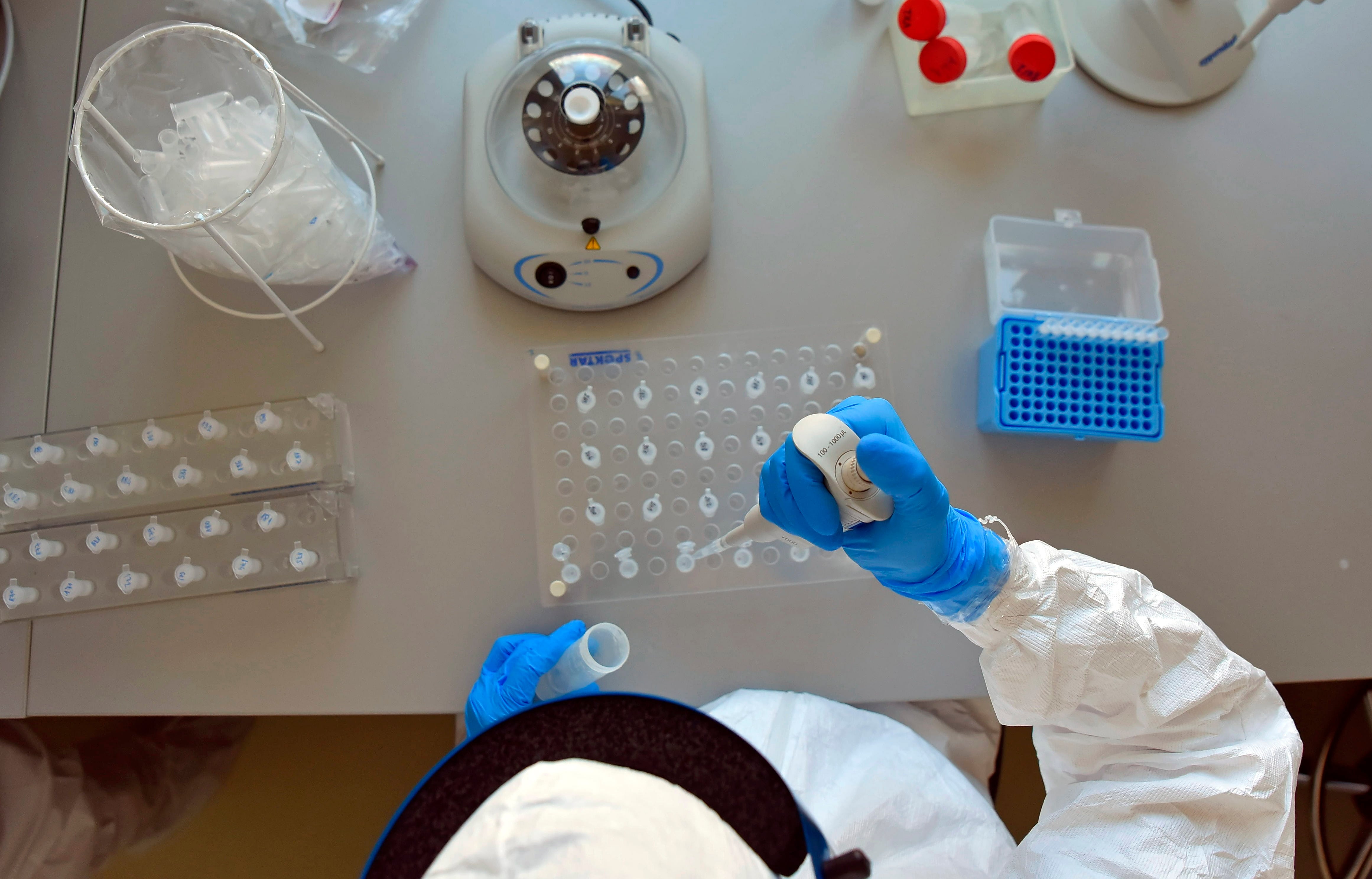El equipo indicó que necesita cientos de miligramos o incluso gramos del metabolito para ampliar estudios en modelos animales (Efe) 